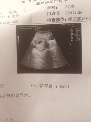 东莞不孕不育检查