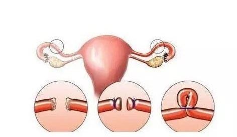 东莞试管婴儿费用