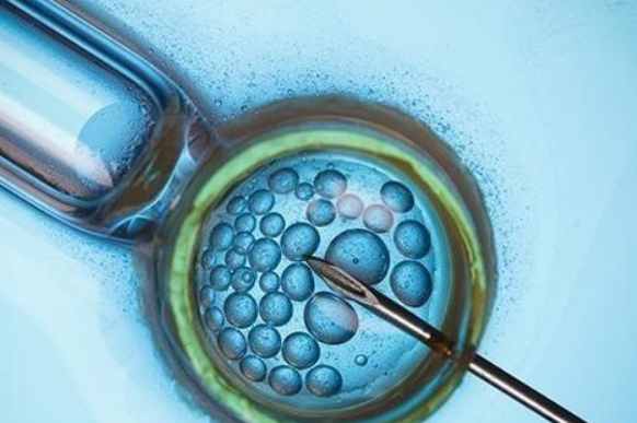 中国人去俄罗斯代孕